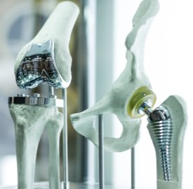 3d printed knee and hip replacement